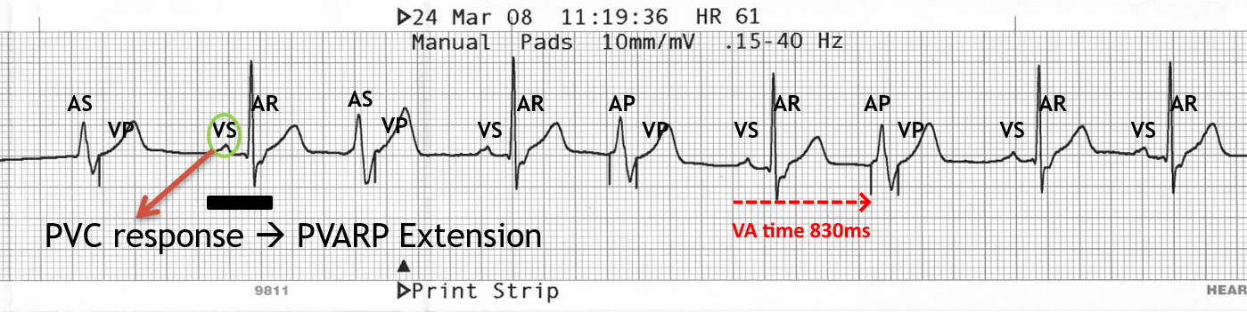 Cardiac Rhythm Device Troubleshooting